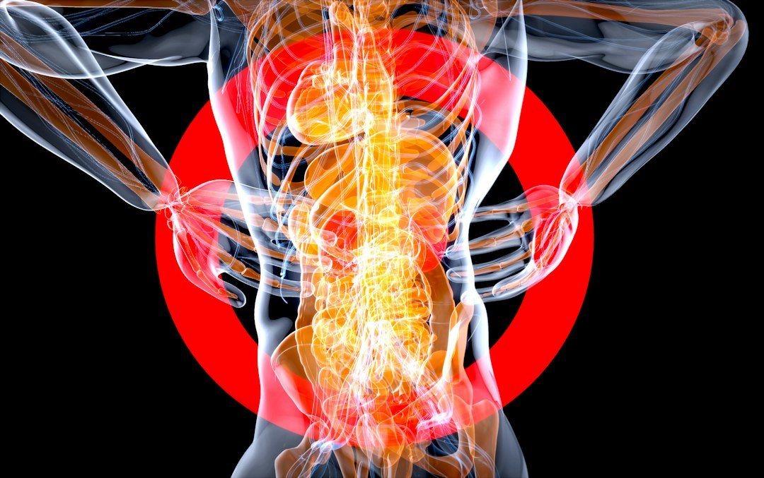 TENS back pain