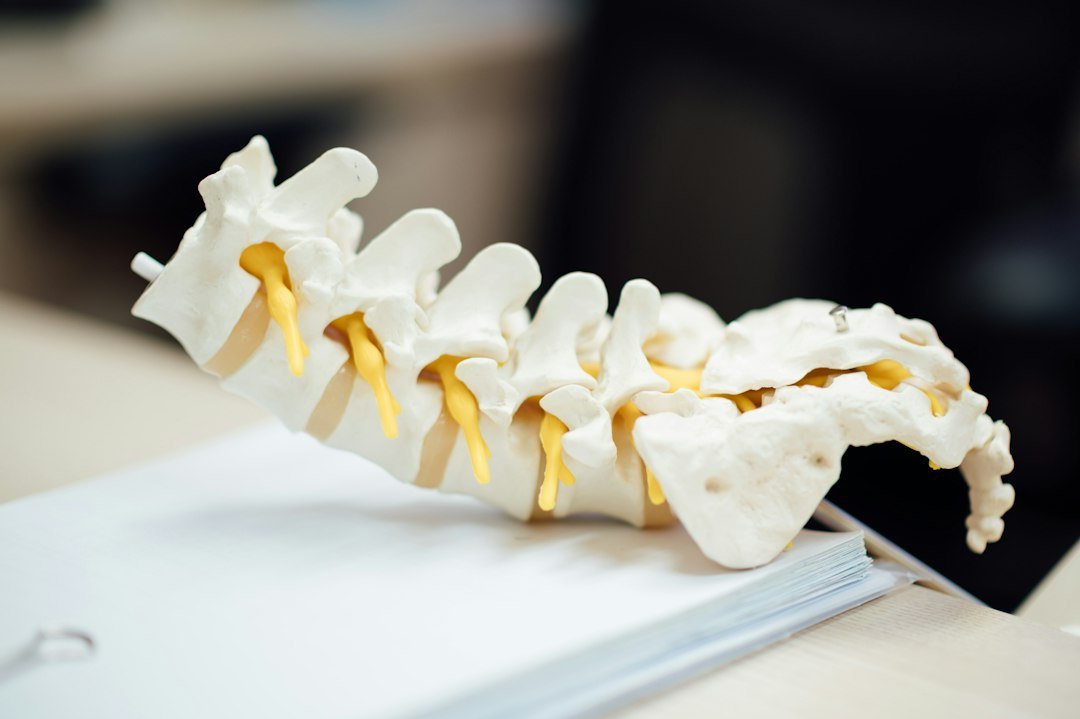 nerve block